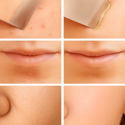 Limpador Facial Ultrasônico SkinGlow – Pele Limpa e Jovem